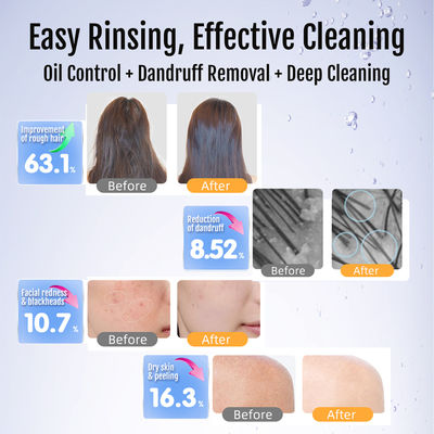 High-Pressure Nano Bubble Shower Head | Cleaner Skin, Softer Hair, and Lasting Brass Quality